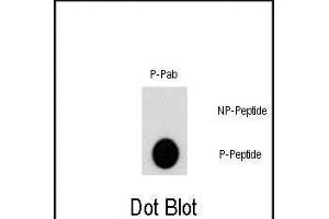 Dot blot analysis of Phospho-AKT2- polyclonal antibody (ABIN389734 and ABIN2839673) on nitrocellulose membrane. (AKT2 抗体  (pSer474))