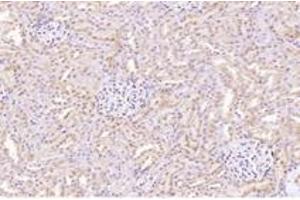 Immunohistochemistry analysis of paraffin-embedded rat kidney using,CTSV (ABIN7073348) at dilution of 1: 2000 (Cathepsin L2 抗体)