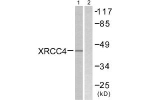 Western blot analysis of extracts from COLO205 cells, using XRCC4 antibody. (XRCC4 抗体  (C-Term))