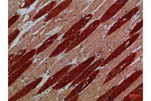 Immunohistochemical analysis of paraffin-embedded Human-skeletal-muscle, antibody was diluted at 1:100