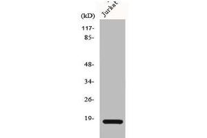 Western Blot analysis of HeLa cells using Cofilin Polyclonal Antibody (Cofilin1/2 (CFL1/2) (Internal Region) 抗体)