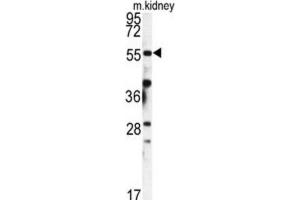 Western Blotting (WB) image for anti-FK506 Binding Protein 9, 63 KDa (FKBP9) antibody (ABIN3003182) (FKBP9 抗体)