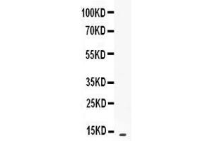 Western blot analysis of CXCL13/BLC expression in recombinant mouse CXCL13/BLC protein 1ng ( Lane 1). (CXCL13 抗体  (AA 22-109))