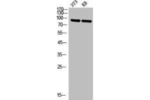 Western Blot analysis of NIH-3T3 KB cells using P-Selectin Polyclonal Antibody (P-Selectin 抗体  (N-Term))