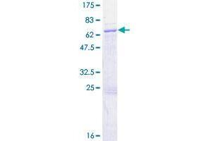 RBM4B Protein (AA 1-359) (GST tag)