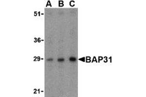 Western Blotting (WB) image for anti-B-Cell Receptor-Associated Protein 31 (BCAP31) (Middle Region) antibody (ABIN1030882) (BCAP31 抗体  (Middle Region))