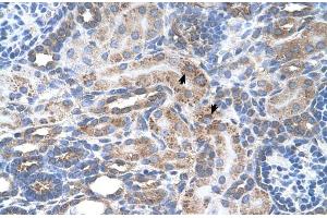 Immunohistochemistry (IHC) image for anti-Solute Carrier Family 29 (Nucleoside Transporters), Member 2 (SLC29A2) (N-Term) antibody (ABIN2781571)