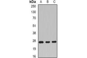 Western blot analysis of Rac 1 expression in BT474 (A), mouse liver (B), rat brain (C) whole cell lysates. (RAC1 抗体)