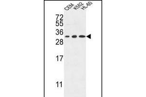 TSN2 Antibody (Center) (ABIN653269 and ABIN2842786) western blot analysis in CEM,K562,HL-60 cell line lysates (35 μg/lane). (Tetraspanin 2 抗体  (AA 109-137))
