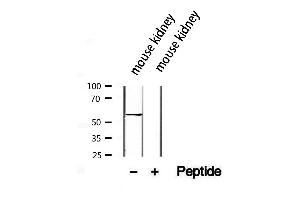 Western blot analysis of extracts from mouse kidney, using SLC13A2 antibody. (SLC13A2 抗体)