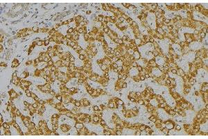 ABIN6276571 at 1/100 staining Mouse liver tissue by IHC-P. (GAS2 抗体  (C-Term))