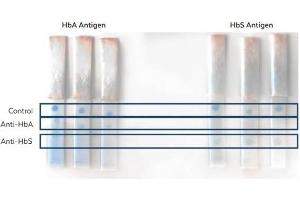 Lateral Flow (LF) image for anti-HbBs (N-Term) antibody (ABIN5706738)