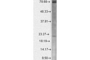 Western Blot analysis of Human Cell line lysates showing detection of Cav Beta2 Calcium Channel protein using Mouse Anti-Cav Beta2 Calcium Channel Monoclonal Antibody, Clone S8b-1 . (CACNB2 抗体  (AA 189-205) (HRP))