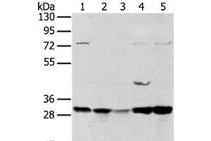 Western Blot analysis of 293T and MCF7 cell, Mouse brain tissue and K562 cell, Mouse bladder tissue using TPD54 Polyclonal Antibody at dilution of 1:400 (TPD52L2 抗体)