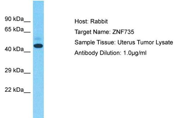 Zinc Finger Protein 735 (ZNF735) (Middle Region) 抗体