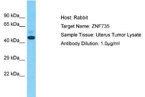 Host: Rabbit Target Name: ZNF735 Sample Type: Uterus Tumor lysates Antibody Dilution: 1. (Zinc Finger Protein 735 (ZNF735) (Middle Region) 抗体)
