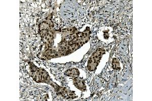 IHC analysis of Transketolase/TKT using anti-Transketolase/TKT antibody (ABIN7598959).