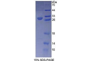 SDS-PAGE analysis of Human RXRg Protein. (Retinoid X Receptor gamma 蛋白)