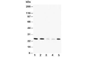 Western blot testing of Pleiotrophin antibody and Lane 1:  rat brain (Pleiotrophin 抗体  (C-Term))
