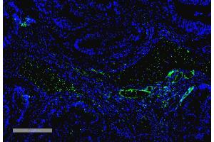 Immunohistochemistry analysis using Mouse Anti-VPS35 Monoclonal Antibody, Clone 10A8 (ABIN6932980). (VPS35 抗体)