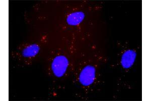 Proximity Ligation Analysis of protein-protein interactions between BID and BAX. (BID 抗体  (AA 1-195))
