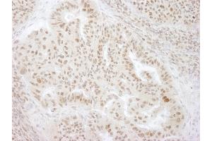 Immunohistochemistry (IHC) image for anti-Kinesin Family Member C1 (KIFC1) (AA 625-673) antibody (ABIN7448624)
