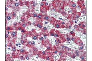 Human Liver: Formalin-Fixed, Paraffin-Embedded (FFPE) (PAR1 抗体  (Internal Region))