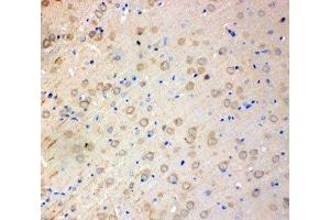 IHC-P: SOD2 antibody testing of rat brain tissue (SOD2 抗体  (N-Term))