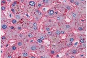 Human Liver (formalin-fixed, paraffin-embedded) stained with APOB antibody ABIN337314 at 5 ug/ml followed by biotinylated anti-goat IgG secondary antibody ABIN481715, alkaline phosphatase-streptavidin and chromogen. (APOB 抗体)