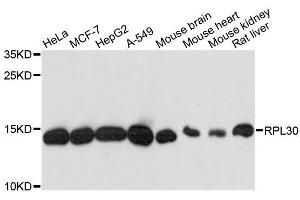 Western blot analysis of extracts of various cell lines, using RPL30 antibody. (RPL30 抗体  (AA 1-115))