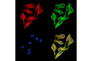 ABIN7095475 and ABIN7099532 staining Hela cells by IF/ICC. (TPD52 抗体)