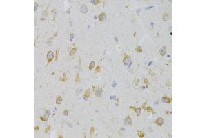 Immunohistochemistry of paraffin-embedded mouse brain using KISS1R Antibody (ABIN3017091, ABIN3017092, ABIN3017093 and ABIN6219946) at dilution of 1:100 (40x lens). (KISS1R 抗体)
