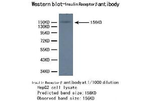 Western Blotting (WB) image for anti-Insulin Receptor beta (ISR-beta) antibody (ABIN1873245) (ISR-beta 抗体)
