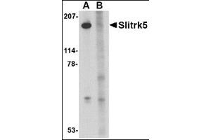 Western blot analysis of Slitrk5 in 3T3 cell lysate with this product at 1 μg/ml in the (A) absence or (B) presence of blocking peptide. (SLITRK5 抗体  (Center))