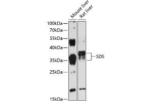 Western blot analysis of extracts of various cell lines, using SDS antibody (ABIN6132920, ABIN6147476, ABIN6147477 and ABIN6216699) at 1:3000 dilution. (serine Dehydratase 抗体  (AA 90-170))