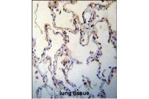 RAGE(AGER) Antibody (C-term) (ABIN389028 and ABIN2839245) immunohistochemistry analysis in formalin fixed and paraffin embedded human lung tissue followed by peroxidase conjugation of the secondary antibody and DAB staining. (RAGE 抗体  (C-Term))