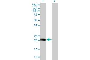 Western Blotting (WB) image for anti-Nucleolar Protein 16 (NOP16) (AA 1-178) antibody (ABIN526755)