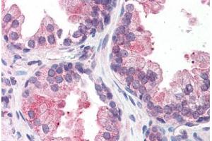 Human Prostate: Formalin-Fixed, Paraffin-Embedded (FFPE)