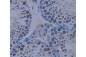 Used in DAB staining on fromalin fixed paraffin- embedded testis tissue (CSRP1 抗体  (AA 1-193))