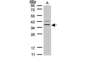 WB Image Sample(30 μg of whole cell lysate) A:H1299 12% SDS PAGE antibody diluted at 1:1000 (Purinergic Receptor P2Y, G-Protein Coupled, 13 (P2RY13) (Internal Region) 抗体)