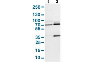 Western Blot analysis with SENP1 polyclonal antibody . (SENP1 抗体  (AA 85-204))