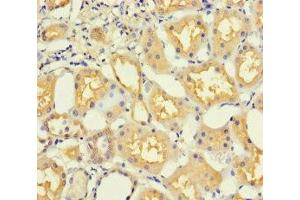 Immunohistochemistry of paraffin-embedded human kidney tissue using ABIN7165919 at dilution of 1:100 (PPP1R16B 抗体  (AA 101-400))