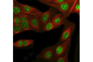IF analysis of RbAp48 using anti-RbAp48 antibody (ABIN3043920) and anti-Beta Tubulin antibody (ABIN7602743).