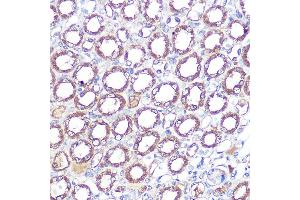 Immunohistochemistry of paraffin-embedded mouse kidney using ERK5 Rabbit mAb (ABIN1680723, ABIN3018327, ABIN3018328 and ABIN7101595) at dilution of 1:100 (40x lens). (MAPK7 抗体)