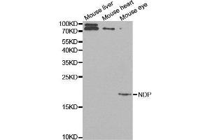 Western blot analysis of extracts of various cell lines, using NDP antibody. (Norrie Disease (Pseudoglioma) 抗体  (AA 25-133))