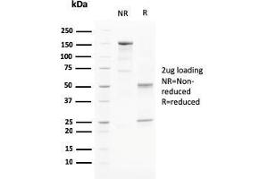 SDS-PAGE Analysis Purified PAPP-A Mouse Monoclonal Antibody (PAPPA/2715). (PAPPA 抗体  (AA 351-523))