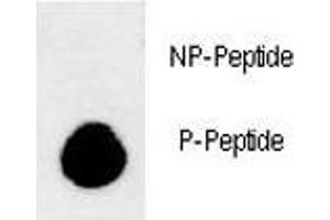 Dot Blot (DB) image for anti-Microtubule-Associated Protein 1 Light Chain 3 beta (MAP1LC3B) (pThr93), (pTyr99) antibody (ABIN3028838)