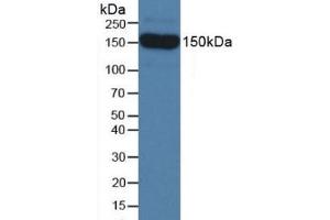 Western Blotting (WB) image for anti-Sema Domain, Seven Thrombospondin Repeats (Type 1 and Type 1-Like), Transmembrane Domain (TM) and Short Cytoplasmic Domain, (Semaphorin) 5B (SEMA5B) (AA 836-1013) antibody (ABIN7437377)