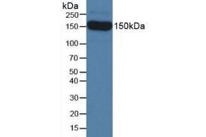 Detection of SEMA5B in Mouse Serum using Polyclonal Antibody to Semaphorin 5B (SEMA5B) (SEMA5B 抗体  (AA 836-1013))