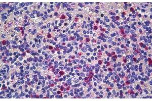 Human Spleen: Formalin-Fixed, Paraffin-Embedded (FFPE) (CD177 抗体  (AA 21-120))